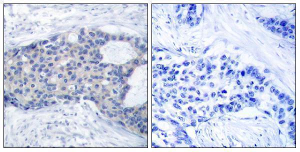 a00754y493 zap70 primary antibodies ihc testing 3