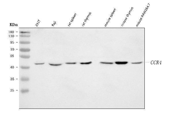  Western blot analysis of CCR4 using anti-CCR4 antibody (A00755-4)