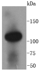 Western blot analysis of ACE2 on human kidney lysates using anti-ACE2 antibody at 1/1,000 dilution