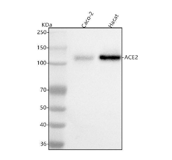  Western blot analysis of ACE2 using anti-ACE2 antibody (A00756-3)