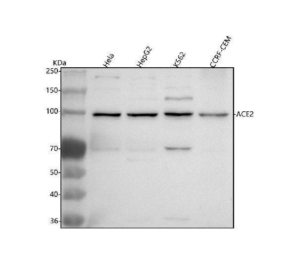  Western blot analysis of ACE2 using anti-ACE2 antibody (A00756-4)
