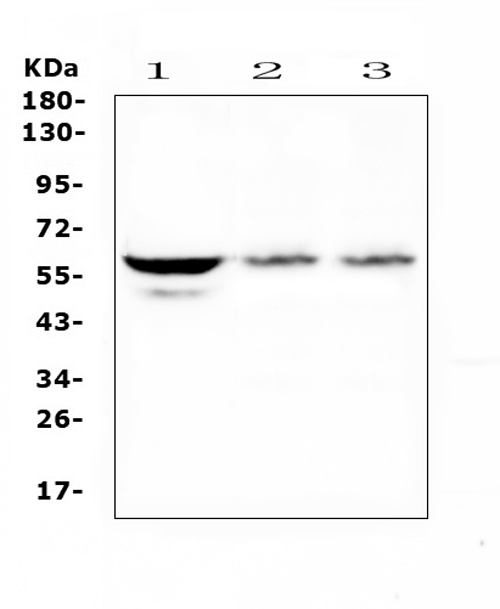 Western blot analysis of SOX10 using anti-SOX10 antibody (A00758-1). Electrophoresis was performed on a 5-20% SDS-PAGE gel at 70V (Stacking gel) / 90V (Resolving gel) for 2-3 hours. The sample well of each lane was loaded with 50ug of sample under reducing conditions. Lane 1: human U-87MG cell lysate, Lane 2: human A375 cell lysate, Lane 3: human A375 cell lysate. After Electrophoresis, proteins were transferred to a Nitrocellulose membrane at 150mA for 50-90 minutes. Blocked the membrane with 5% Non-fat Milk/ TBS for 1.5 hour at RT. The membrane was incubated with rabbit anti-SOX10 antigen affinity purified polyclonal antibody (Catalog # A00758-1) at 0.5 μg/mL overnight at 4°C, then washed with TBS-0.1%Tween 3 times with 5 minutes each and probed with a goat anti-rabbit IgG-HRP secondary antibody at a dilution of 1:10000 for 1.5 hour at RT. The signal is developed using an Enhanced Chemiluminescent detection (ECL) kit (Catalog # EK1002) with Tanon 5200 system. A specific band was detected for SOX10 at approximately 60KD. The expected band size for SOX10 is at 50KD.