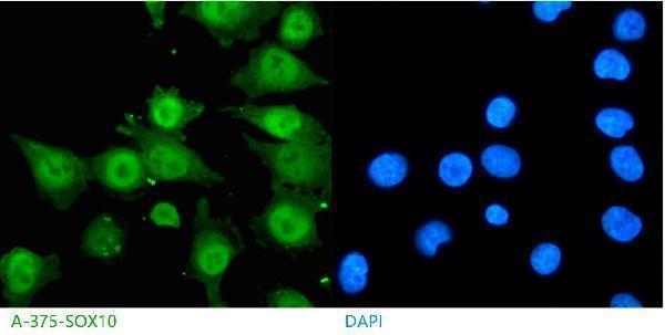 IF analysis of SOX10 using anti-SOX10 antibody (A00758-3)