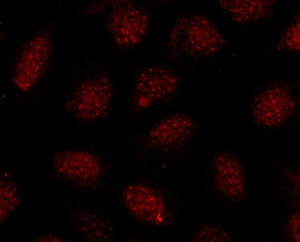  IF analysis of SOX10 using anti-SOX10 antibody (A00758-3)
