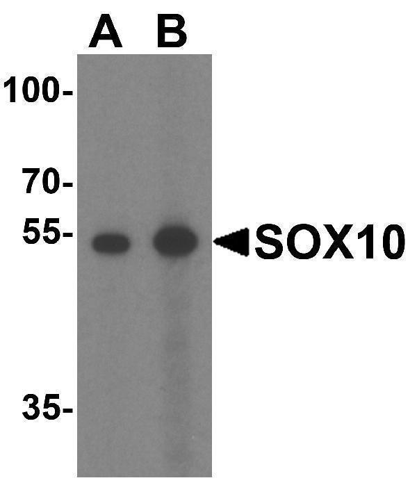 Western blot analysis of SOX10 in rat heart tissue lysate with SOX10 antibody at (A) 1 and (B) 2 μg/mL