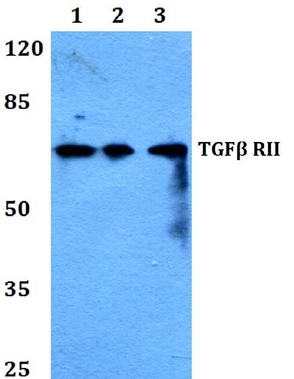 Western blot (WB) analysis of TGFβ RII (I122) polyclonal antibody at 1:500 dilution
Lane1:Hela whole cell lysate
Lane2:Raw264