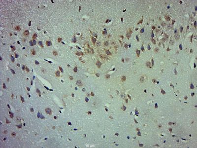 a00760 4 olr1 primary antiboties ihc testing 3