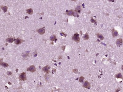 a00760 4 olr1 primary antiboties ihc testing 4
