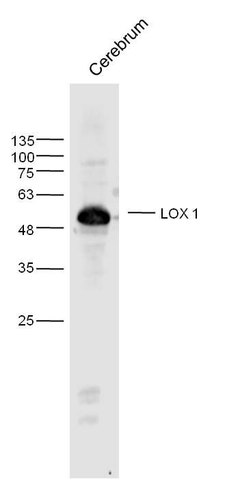 a00760 4 olr1 primary antiboties wb testing 1