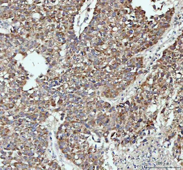 a00761 1 pah primary antibodies ihc testing 2