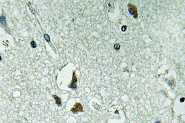 Immunohistochemistry (IHC) analyzes of PAH (R400) pAb in paraffin-embedded human brain tissue