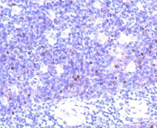 a00762 2 aurkb primary antiboties ihc testing 2