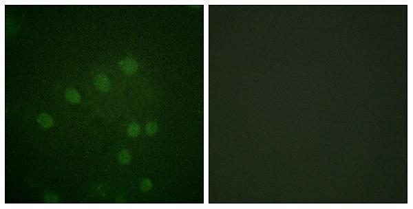 Immunofluorescence analysis of HepG2 cells, using AurB (Phospho-Thr232) Antibody