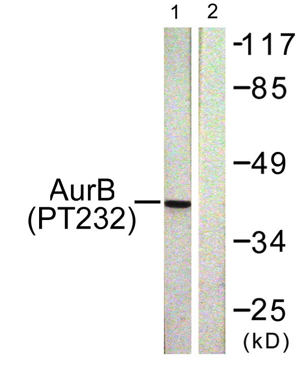 Western blot analysis of lysates from COS7 cells treated with Nocodazole 1ug/ml 16h, using AurB (Phospho-Thr232) Antibody