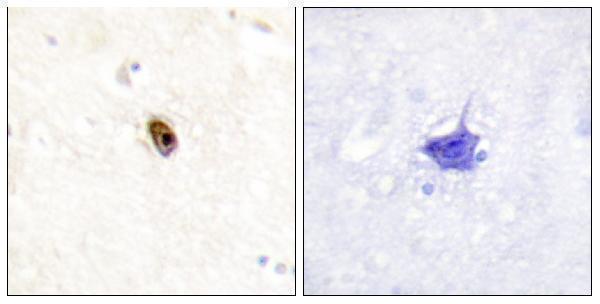 Immunohistochemistry analysis of paraffin-embedded human brain, using AurB/C (Phospho-Thr236/202) Antibody