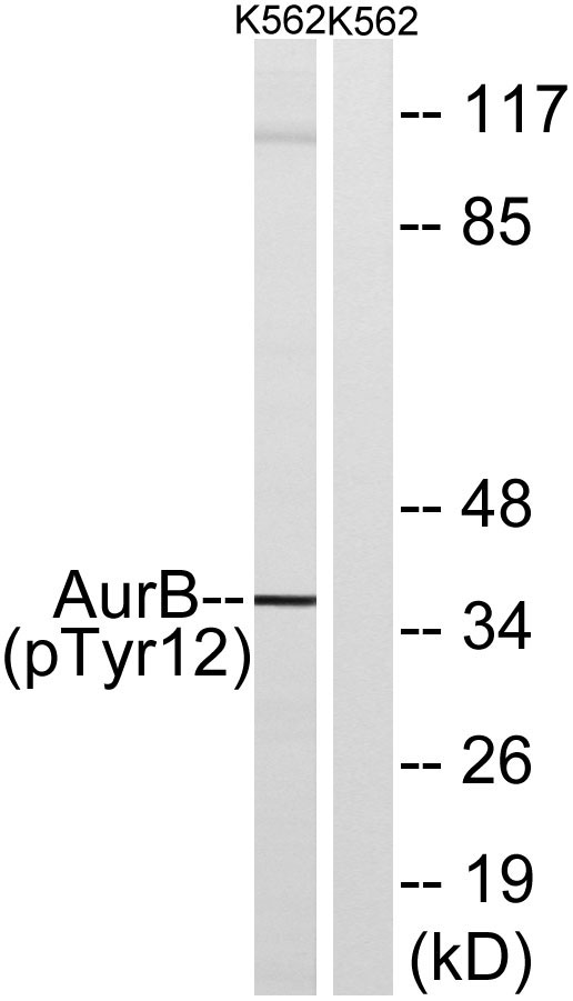 Western blot analysis of lysates from K562 cells, using AurB (Phospho-Tyr12) Antibody