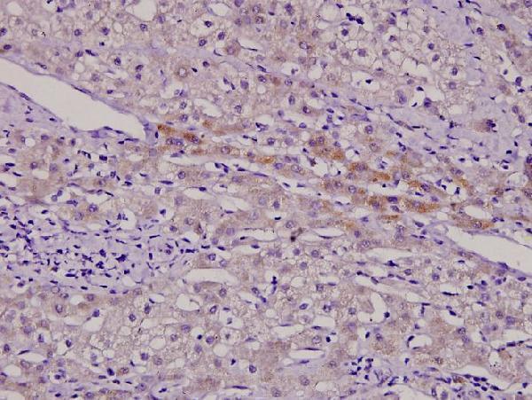 a00762y8 aurkb primary antiboties ihc testing 2