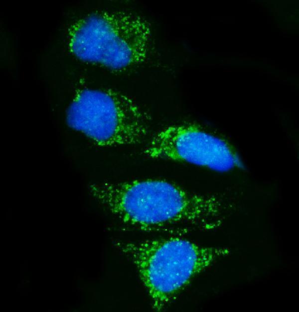  IF analysis of Pyrin/MEFV using anti-Pyrin/MEFV antibody (A00764-1)
