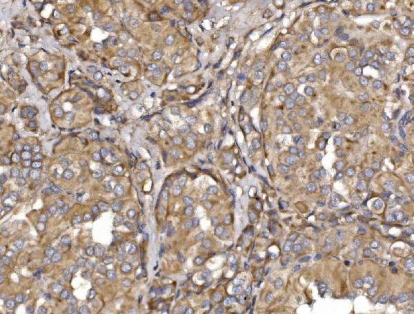  IHC analysis of Pyrin/MEFV using anti-Pyrin/MEFV antibody (A00764-1)