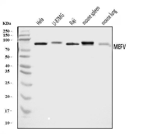  Western blot analysis of Pyrin/MEFV using anti-Pyrin/MEFV antibody (A00764-1)