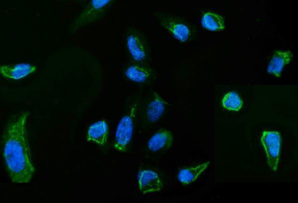 a00766 1 msn primary antibodies if testing 5