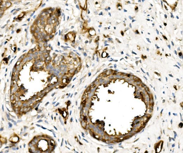  IHC analysis of MSN using anti-MSN antibody (A00766-1)