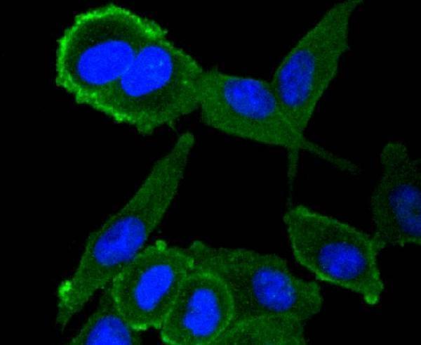 a00766 2 msn primary antiboties icc testing 2