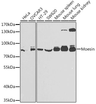 Western blot analysis of extracts of various cell lines, using Moesin antibody  at 1:1000 dilution