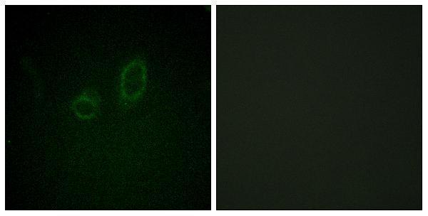 Immunofluorescence analysis of A549 cells, using Moesin/Ezrin/Radixin (Phospho-Thr558) Antibody