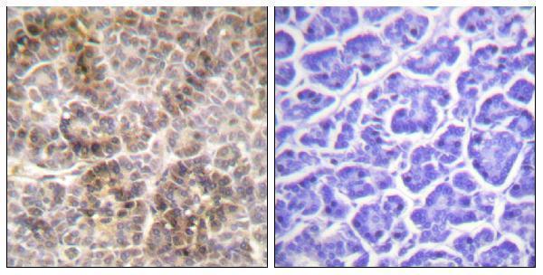 Immunohistochemistry analysis of paraffin-embedded human pancreas, using Moesin/Ezrin/Radixin (Phospho-Thr558) Antibody