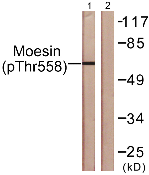 Western blot analysis of lysates from NIH/3T3 cells, using Moesin/Ezrin/Radixin (Phospho-Thr558) Antibody