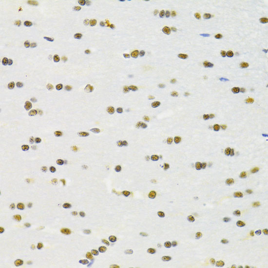 Immunohistochemistry of paraffin-embedded rat brain using RBPJKK Antibody  at dilution of 1:100 