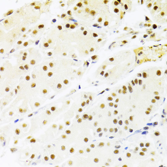 Immunohistochemistry of paraffin-embedded human stomach using RBPJKK Antibody  at dilution of 1:100 