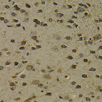 Immunohistochemistry of paraffin-embedded mouse brain using OGG1 antibody  at dilution of 1:200 