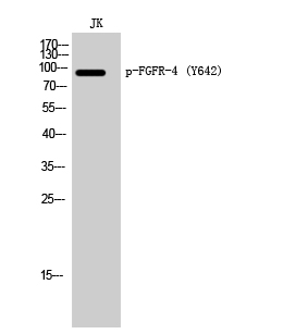 Western Blot analysis of JK cells using Phospho-FGFR-4 (Y642) Polyclonal Antibody