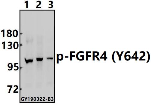 Western blot (WB) analysis of FGFR4 (phospho-Y642) polyclonal antibody at 1:500 dilution
Lane1:HepG2 whole cell lysate(40ug)
Lane2:SGC7901 whole cell lysate(40ug)
Lane3:Panc1 whole cell lysate(40ug)