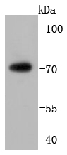 a00771 2 fus primary antiboties wb testing 1