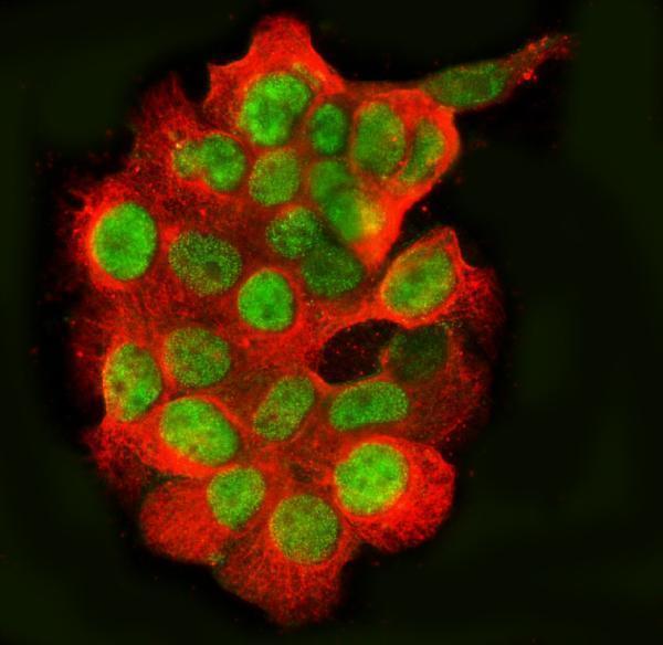 a00771 3 fus primary antibodies if testing 5