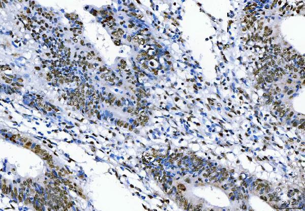  IHC analysis of TLS/FUS using anti-TLS/FUS antibody (A00771-3)