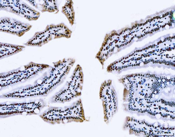  IHC analysis of TLS/FUS using anti-TLS/FUS antibody (A00771-3)