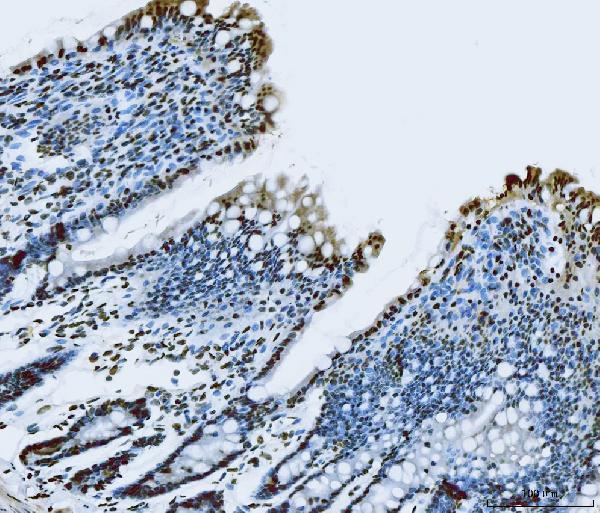 a00771 3 fus primary antibodies ihc testing 4