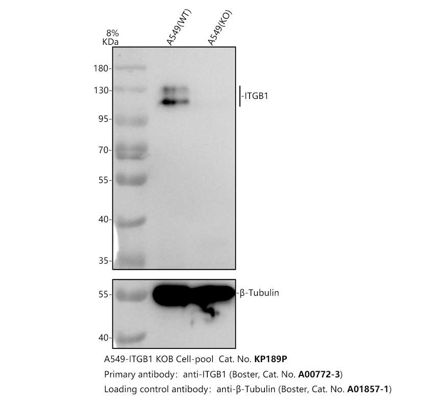 Western blot analysis of Integrin Beta 1/ITGB1 using anti-Integrin Beta 1/ITGB1 antibody (A00772-3)