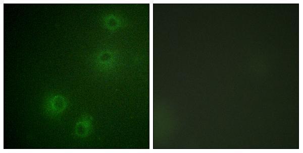 Immunofluorescence analysis of COS7 cells, using Integrin beta1 (Phospho-Thr789) Antibody