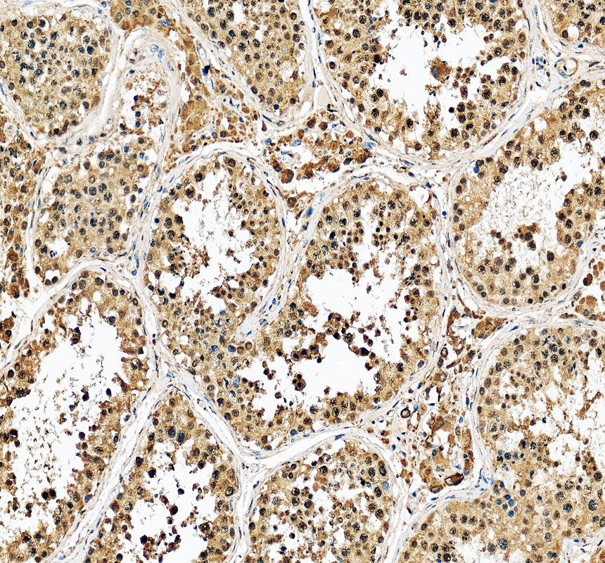 a00776 3 bub1 primary antibodies ihc testing 1