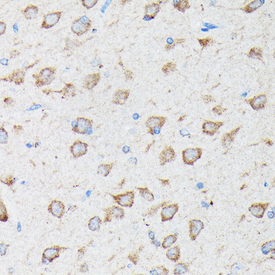 Immunohistochemistry of paraffin-embedded rat brain using CYLD Rabbit pAb  at dilution of 1:100 