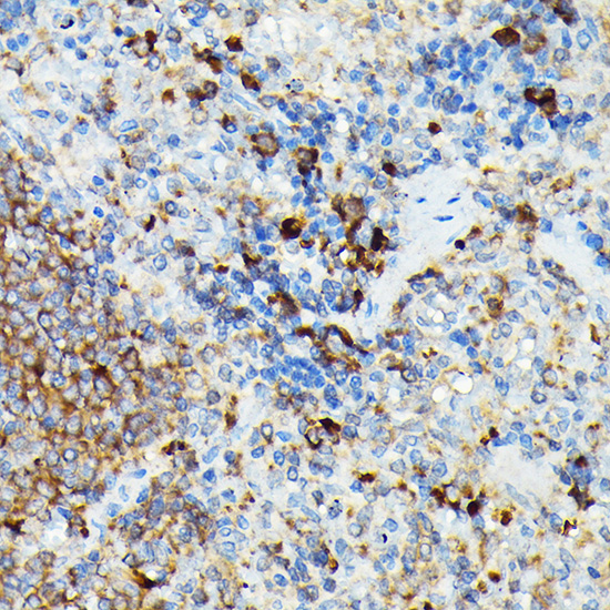 Immunohistochemistry of paraffin-embedded rat spleen using CYLD Rabbit pAb  at dilution of 1:100 
