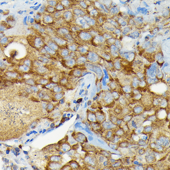 a00779 cyld primary antiboties ihc testing 4