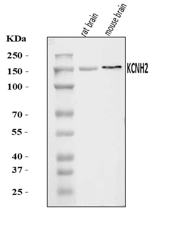  Western blot analysis of H-ERG/KCNH2 using anti-H-ERG/KCNH2 antibody (A00781-2)