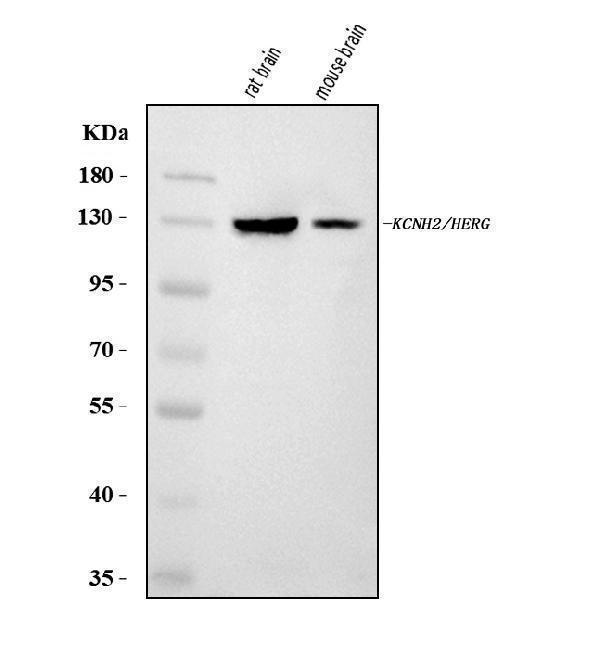  Western blot analysis of H-ERG/KCNH2 using anti-H-ERG/KCNH2 antibody (A00781-3)