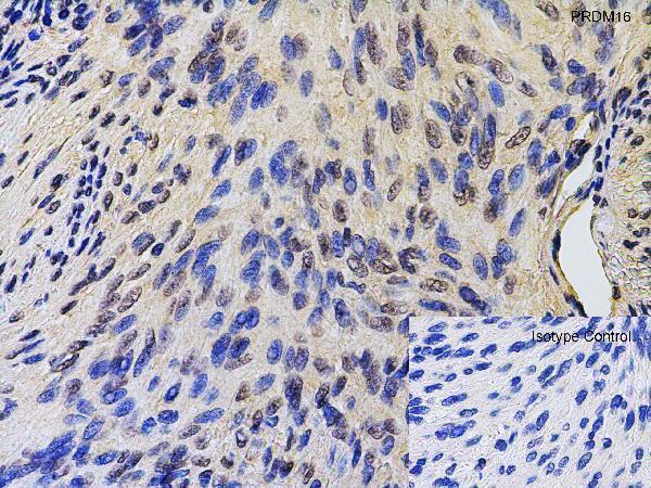 a00782 prdm16 primary antibodies ihc testing 5